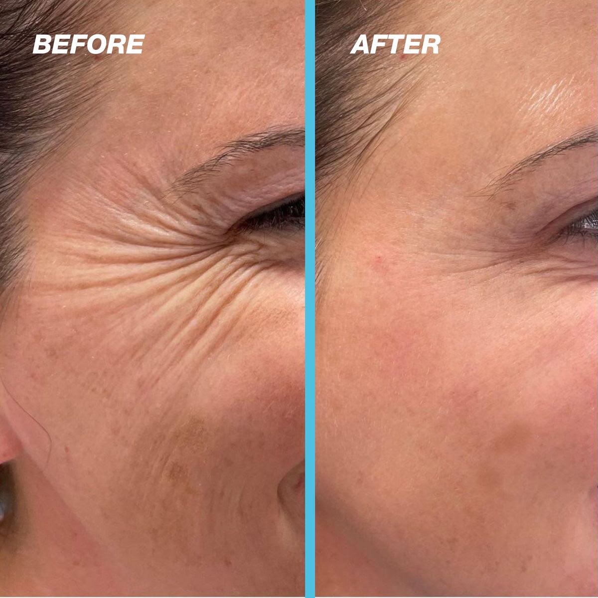 COLAGENO ENCAPSULADO 30GR
