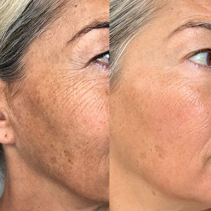 COLAGENO ENCAPSULADO 30GR
