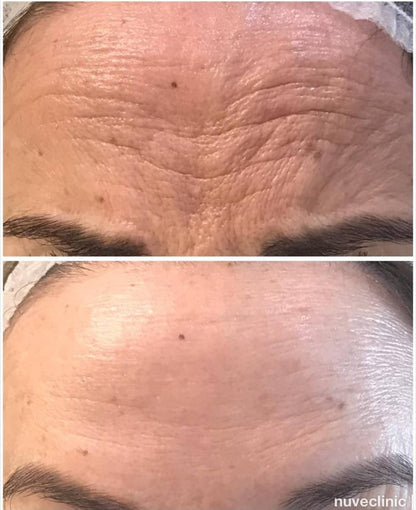 COLAGENO ENCAPSULADO 30GR